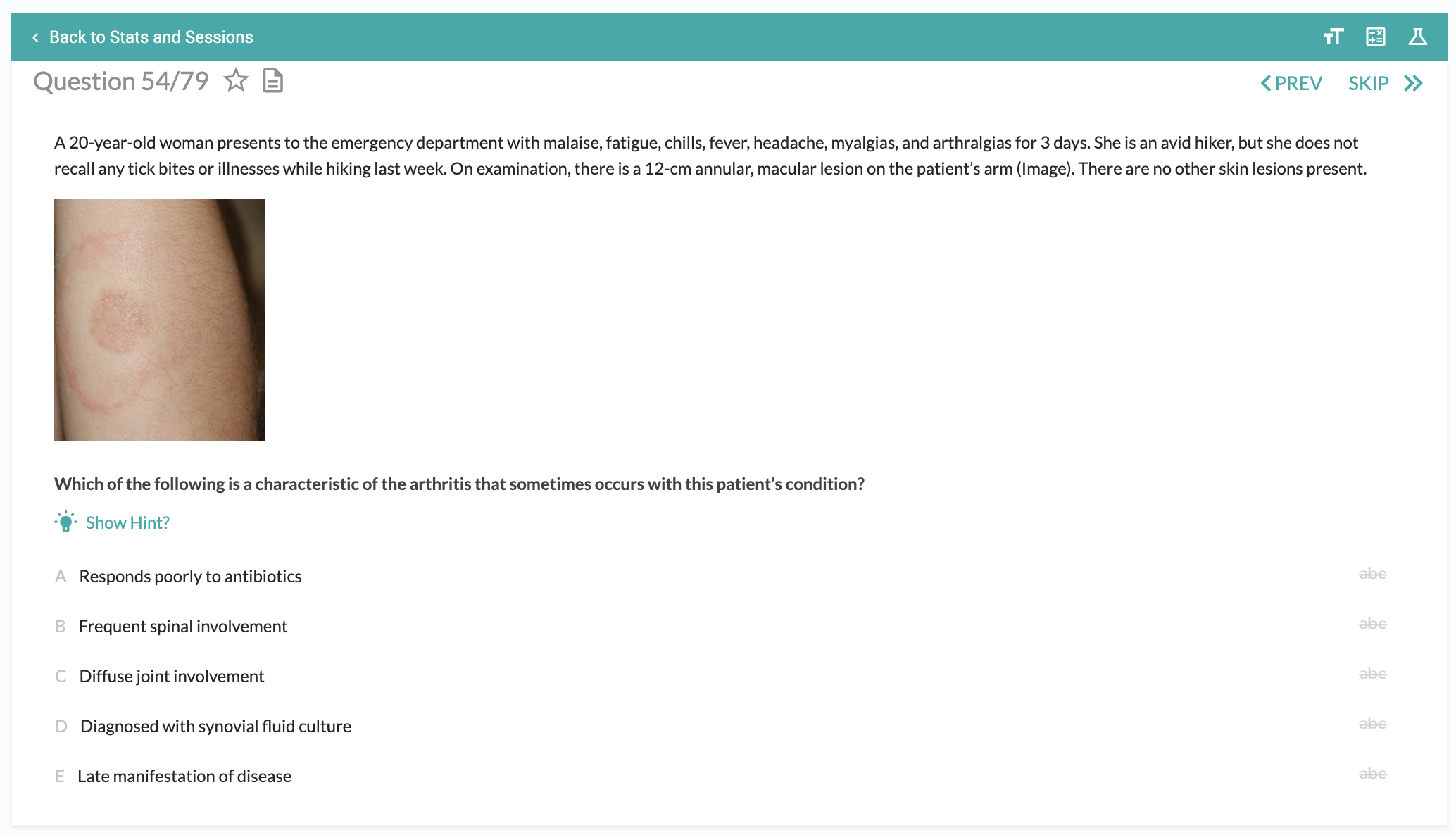 6 tips to break down the USMLE question format